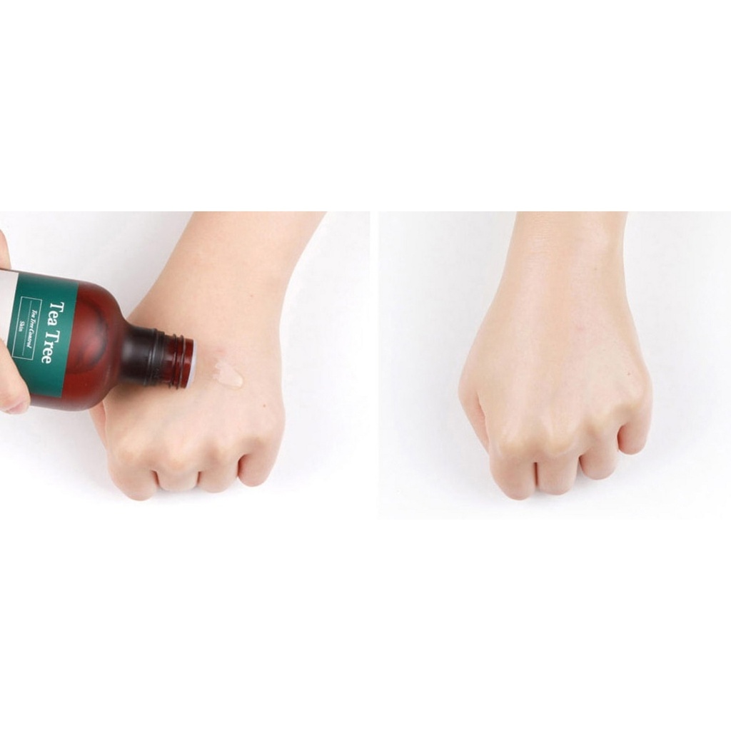 https://www.celmadekorea.com/wp-content/uploads/product_image/SKU_W78P5K_1IO503I_6.jpg
