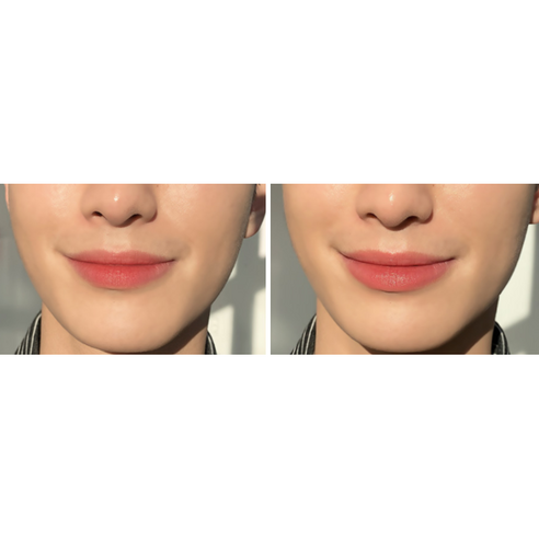 https://www.celmadekorea.com/wp-content/uploads/product_image/SKU_2PF5OO6_4RAM9XE_5.jpg