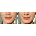 https://www.celmadekorea.com/wp-content/uploads/product_image/SKU_2PF5OO6_4RAM9XE_5.jpg